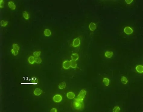  Cryptosporidium - A Tiny Terror Lurking In Your Drinking Water?!