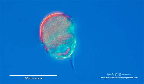  Urocentrum - Ten Tiny Ciliate That Thinks It's a Ballerina!